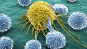 Sienna hopes its $30 tests will aid the early detection of cancer. Source: Getty