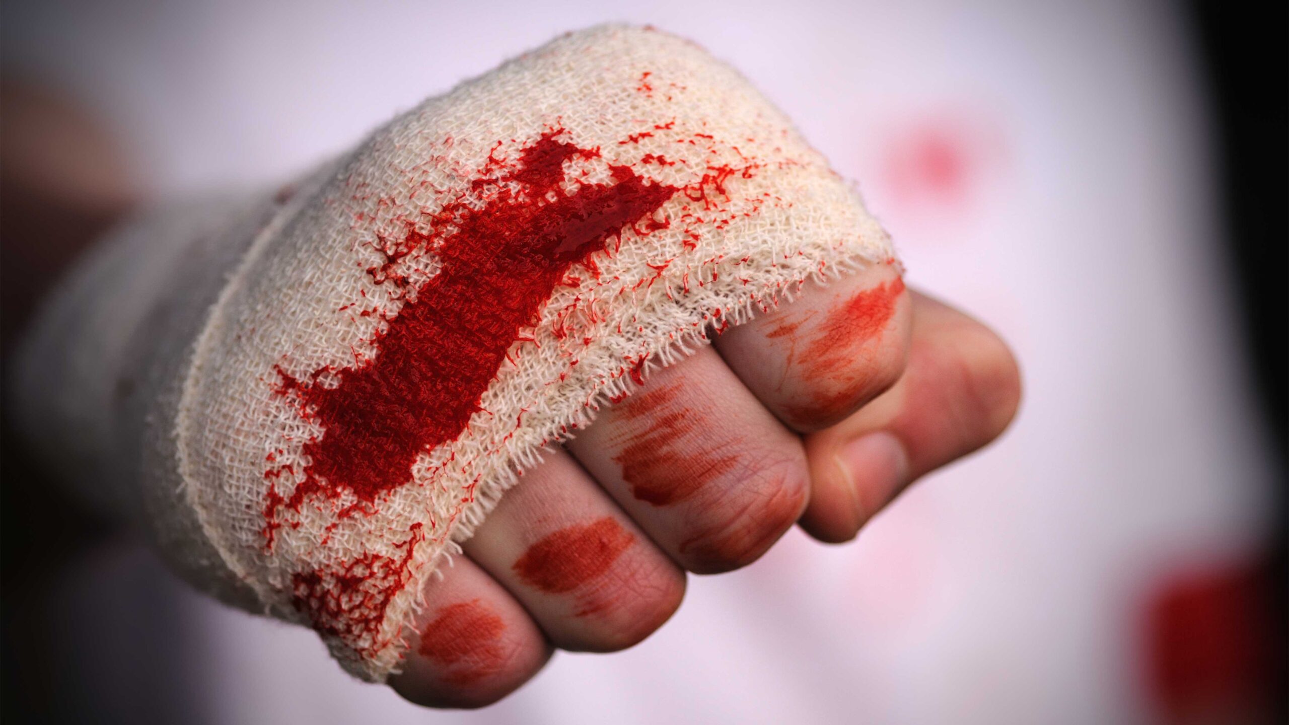 Bloody-knuckles