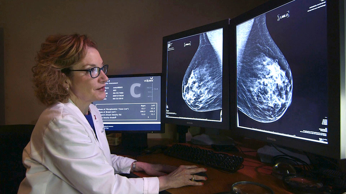 Volpara's technology automates the assessment of breast density. Picture: Volpara