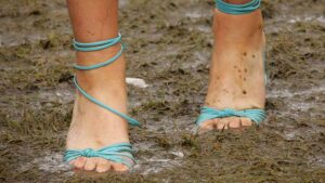 Squishy toes ... Acrux wants to market generic anti-fungal creams in the US. Picture: Getty