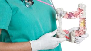 Radiologists call for CTC bowel cancer scans, but a better option is close