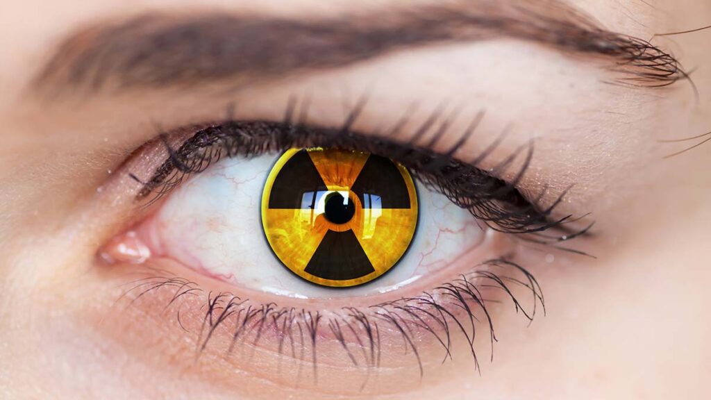Radiation eye, Getty