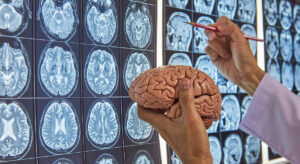 IPO Watch: Invex Pharma wants to use a diabetes drug to treat brain injuries