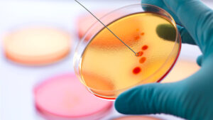 Health: Rhythm Biosciences scores a breakthrough with its cancer-detection treatment