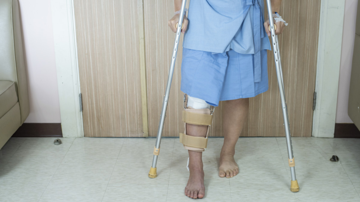 Какие костыли после операции. Crutches in a Hospital. Девушка на костылях в больнице.