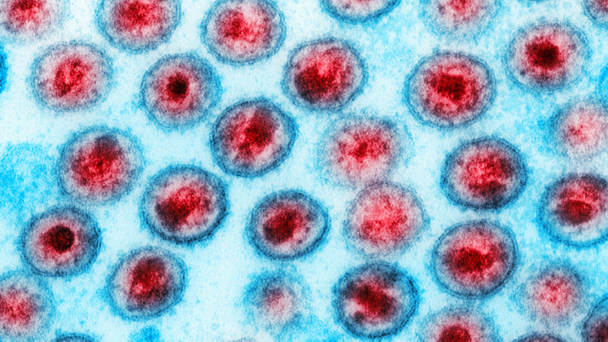 Health: Biotron’s anti-HIV therapy could mean patients may not need treatment forever