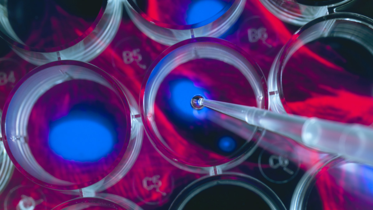 Cynata stem cell technology a triumph: scientist