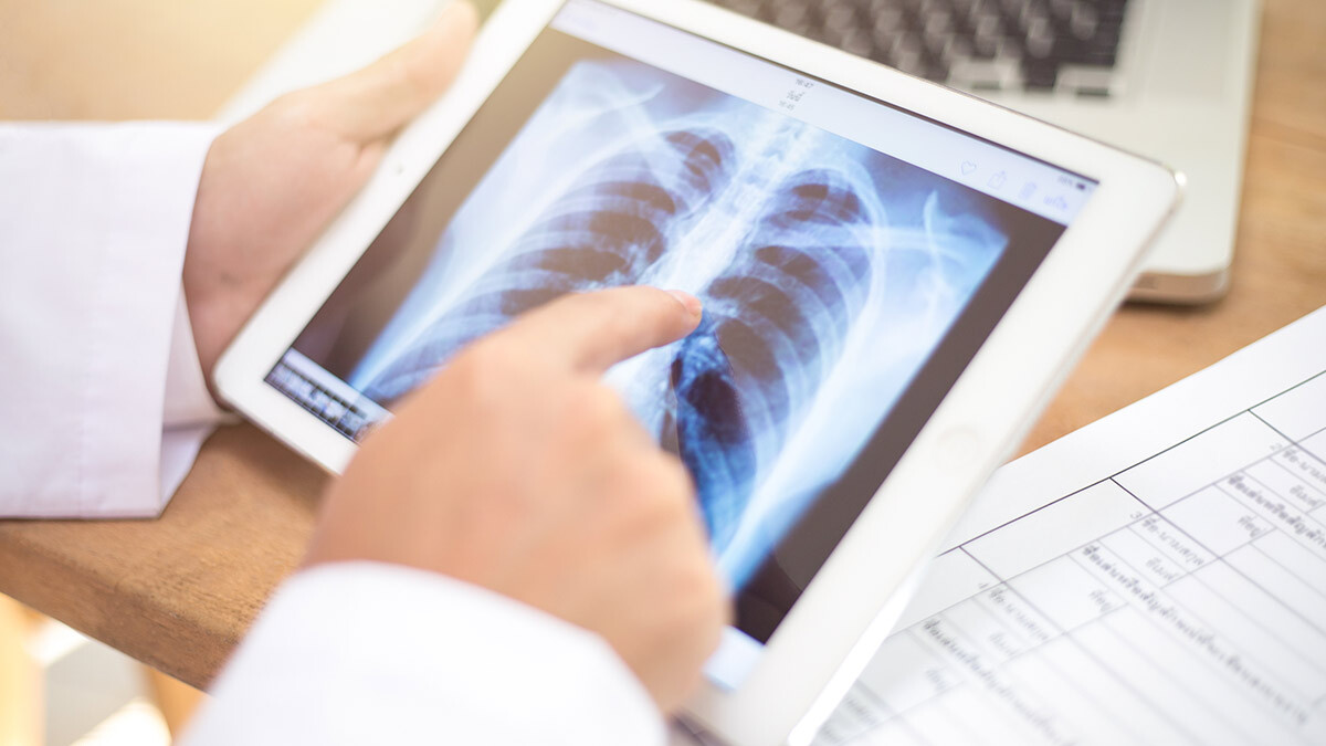 Dimerix wins $1m grant to test DMX-200 treatment in the fight against COVID-19