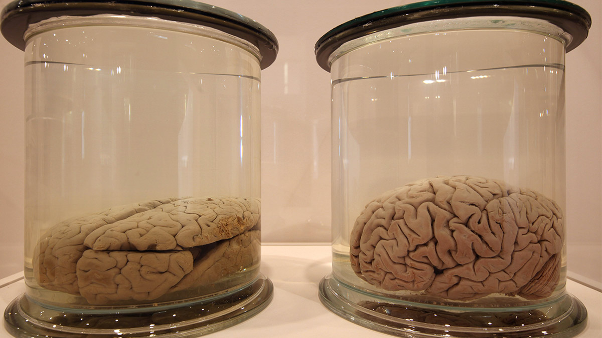 total brain