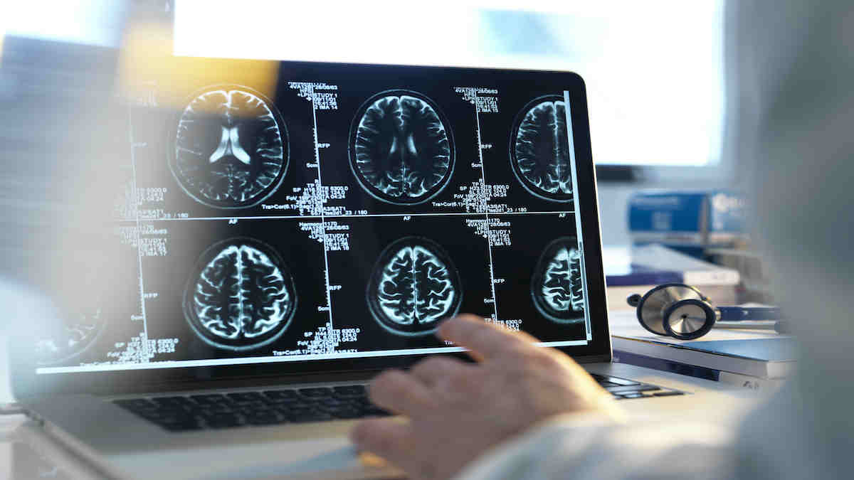 Neurotech international nti