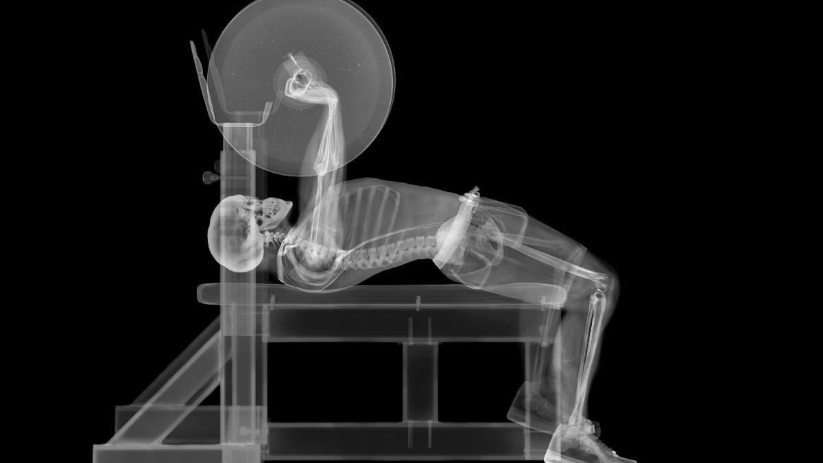 Osteopore ASX OSX