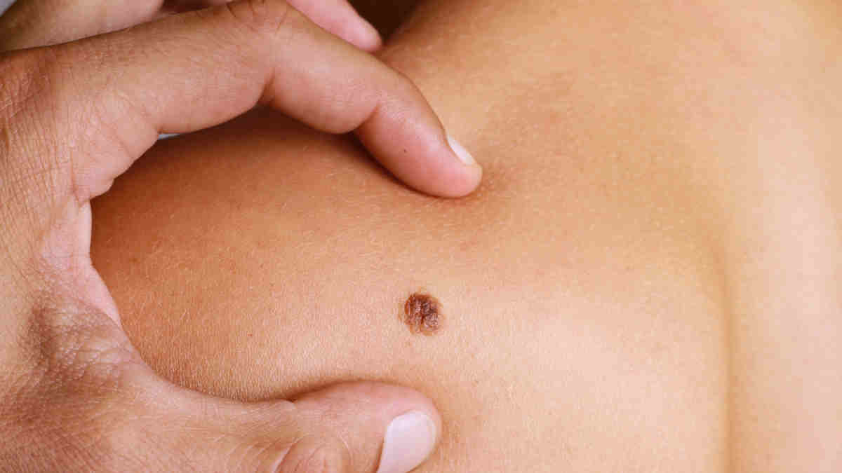 moderna cancer vaccine
