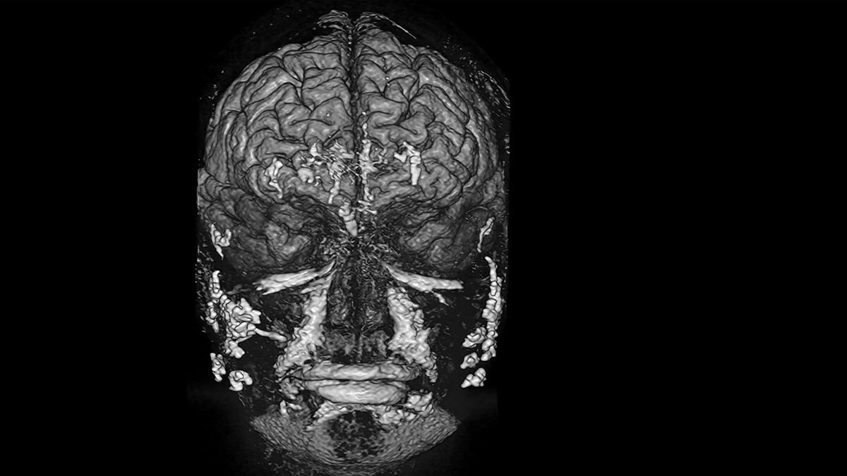 ASX Medical imaging