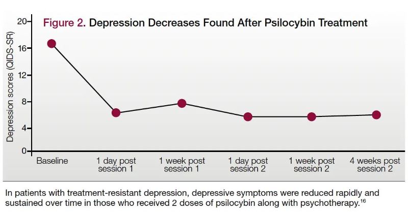 psilocybin depression (IHL)