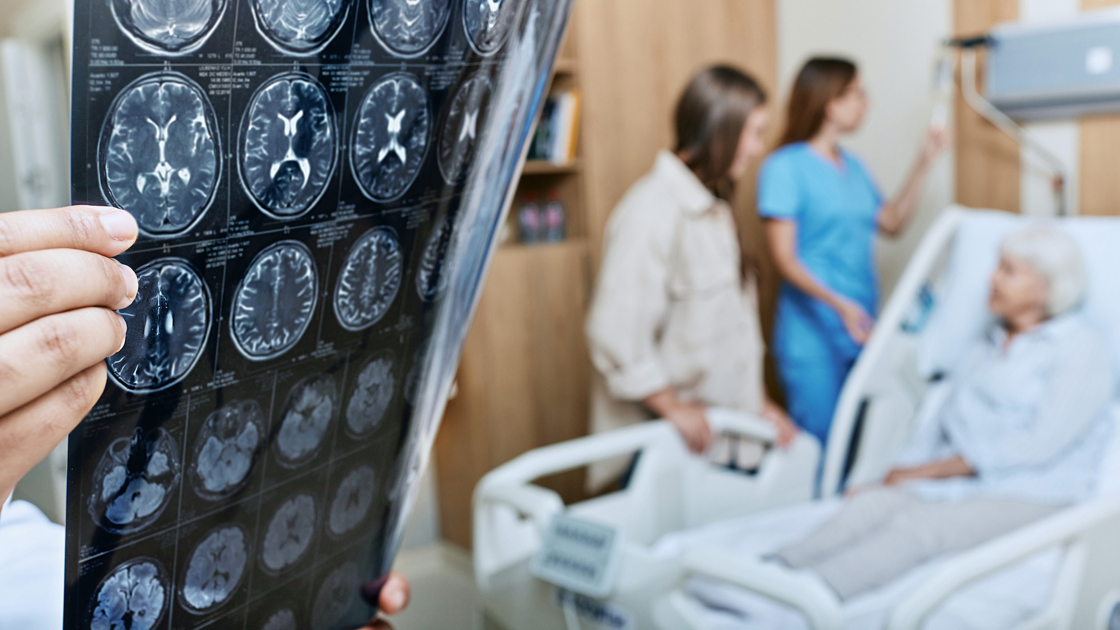 asx stroke biotech AGN
