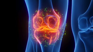 Unicorns Podcast: Changing the Paradigm (ASX:PAR) – Revolutionising osteoarthritis management