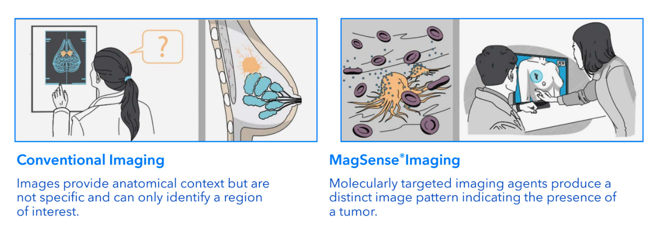 Imagion, Biosystems, ASX, IBX, MagSense, Cancer, Study, MRI