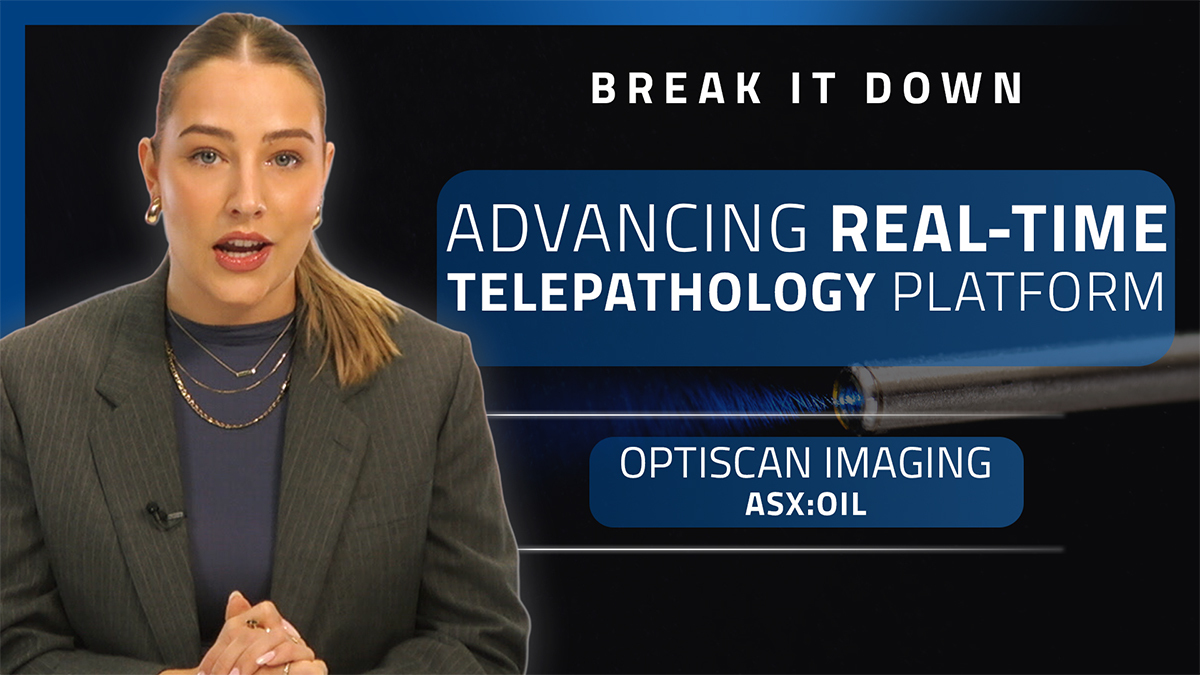 Optiscan Imaging asx OIL