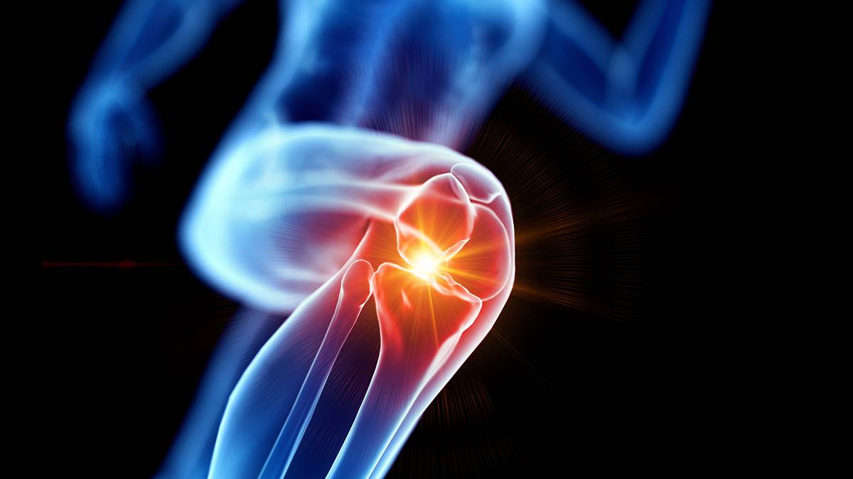 Unicorns Podcast: New low-dose supplement tackles knee pain as joint health market booms