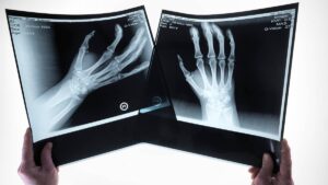 Biocurious: In clinical terms, Singular Health ensures the right arm knows what the left arm is doing