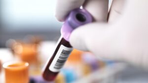 Rhythm Biosciences (ASX:RHY)